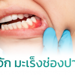 รู้จัก มะเร็งช่องปาก