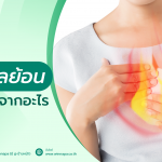 กรดไหลย้อน,กรดไหลย้อนคืออะไร,อาการกรดไหลย้อน,สาเหตุกรดไหลย้อน