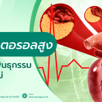 คอเลสเตอรอลสูง,คอเลสเตอรอลสูงเกิดจากอะไร,คอเลสเตอรอลสูงคืออะไร,คอเลสเตอรอลสูงต้องทำยังไง